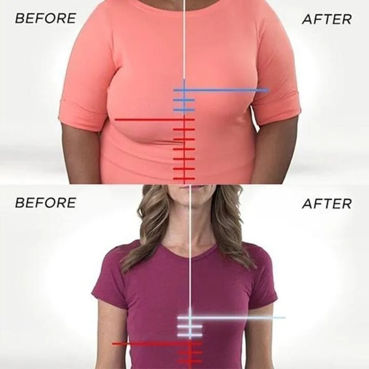 Penelope™ | Ultra-Comfort Scalloped Wireless Bra 1 + 1 FREE